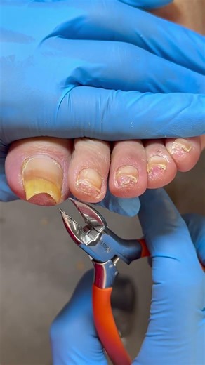 Easy pedicure video, with crisp clicking sounds. #satisfying