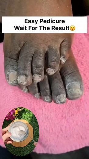 Clean Feet Dirt & Tanning Easily | Fair Feet Tips & Trick . . . #dirt #tanning #feetdirtcleaning #feettanningcleaning #fairfeet #feetcare #reelsvideoシ #reelsfypシ #fbreelsfypシ゚ #reelschallenge | Back to nature remedy