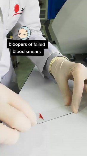 Tips for Better Blood Smears: Avoid Coffee Beforehand