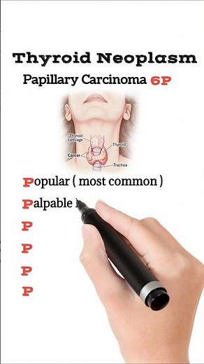 Thyroid Neoplasm | Papillary Carcinoma