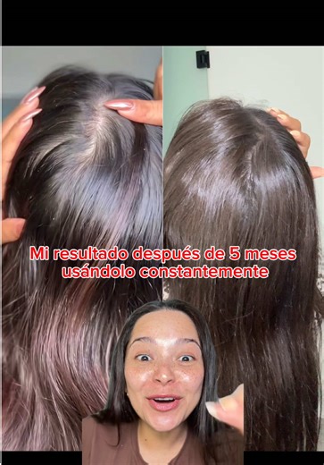 Resultados sorprendentes con PDRN Reedle Shot de VT Cosmetics