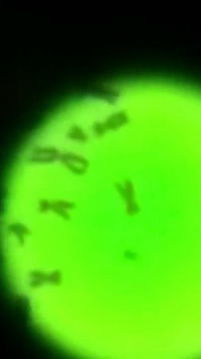 Chromosomes-Under Microscope-Human Genetic