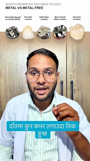 दाँतको कभर: कुन लगाउदा राम्रो हुन्छ?