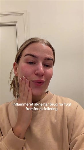 Lyt med til sidst eller spol til enden for at få min guide til hvad jeg ville gøre hvis jeg havde meget akne ligenu🧘🏽‍♀️