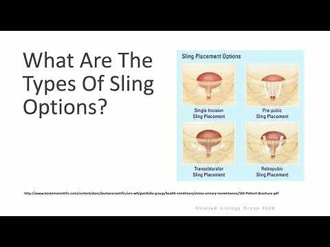 Mid Urethral Sling for Stress Urinary Incontinence in Women