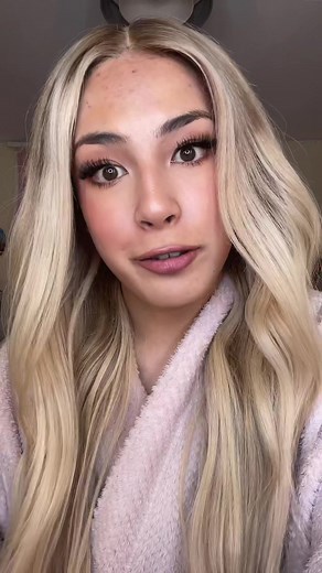 6 Month Braces Transformation: Before and After | Honest Review