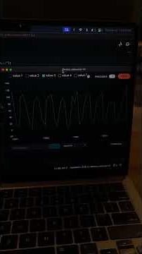 I Built a Muscle-Controlled Switch! (Arduino EMG Sensor Project)
