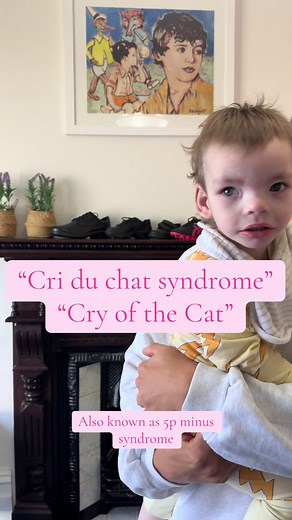 Cri du Chat Syndrome: Facts & Awareness