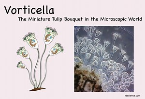 Vorticella – The Miniature Tulip Bouquet in the Microscopic World