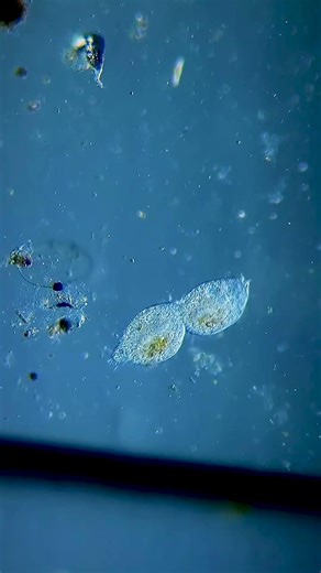 The Secret of Eternal Life? #microbiology #regeneration #microcosmos #discovery