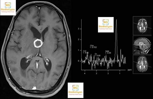 700  Aunt-Minnie Radiology Spotters Cases for Board Exams