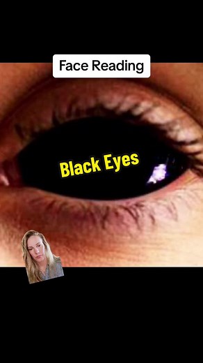 Understanding Black Eyes: Meaning and Interpretation