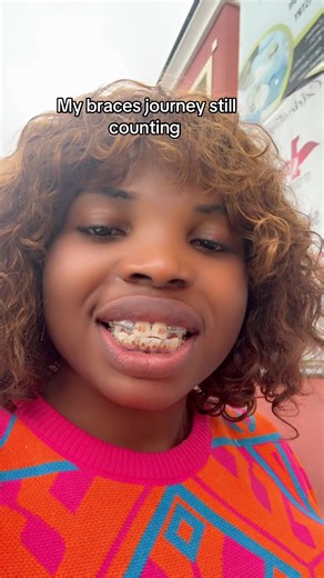 My Ongoing Braces Journey