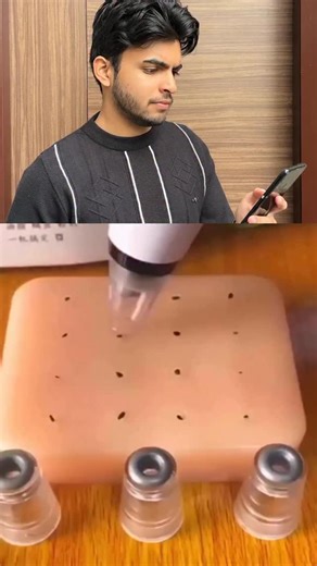 Aashish | Skincare • Haircare• Style on Instagram: "Comment “Link” for this tool Blackhead removal suction tool can work, but only if you use it the right way. Wrong use can damage your skin. Here’s the correct and safe method explained simply. How to use a blackhead suction tool correctly: Clean your face with a gentle face wash to remove dirt and oil. Steam your face for 5–7 minutes to open clogged pores. Start with the lowest suction level, especially if you’re a beginner. Glide the tool slow