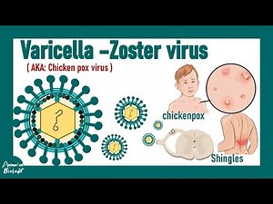 Varicella Zoster Virus | Chicken pox and Shingles | pathology , diagnosis and treatment