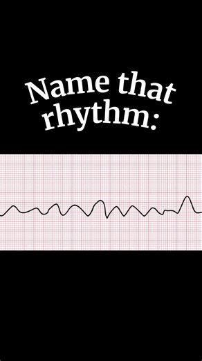 A rapid, life-threatening cardiac arrhythmia that requires immediate CPR and defibrillation 🚨🆘 #arrhythmia #cardiacarrest #acls #nursingschool #rn #nclex #registerednurse #nursetok