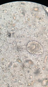 139K views · 1.3K reactions | Direct fecal smear #lablife #medicallaboratory #microbiology | Lab life | Facebook