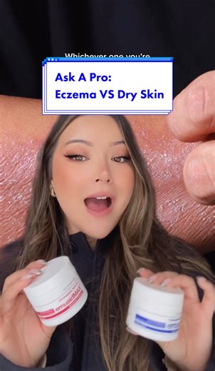 Eczema vs. Dry Skin: Key Differences Explained