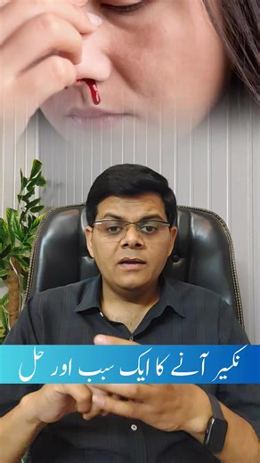 Nosebleed (Epistaxis) Causes & Treatment - Naak se Khoona Ana - Nakseer Phootna #shorts | Dr. Shoaib Sabir