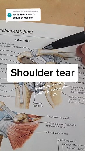 Understanding Shoulder Tears: Symptoms, Treatment, and Recovery