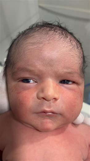 Cute Little Baby in NICU for Warmth & Care 👶🤲❤️ #NICUBaby #NewbornCare🤲🙏❤️