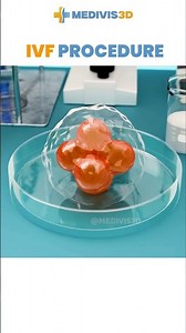IVF Procedure Step by Step | Test Tube Baby Process Explained 🧬👶
