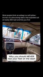 If you ride with your feet on the dash, watch this. That airbag deploys at 200 MPH in less than 0.05 seconds. Now imagine your knees and feet in the way. I've seen the aftermath in the OR—shattered femurs, dislocated hips, broken ankles, facial fractures from your own knees hitting your face. Injuries that require multiple surgeries and months of recovery. Airbags are designed to protect your chest and head when you're sitting properly. When your feet are up? That same safety feature becomes a c