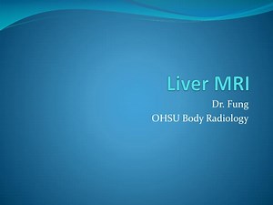 Liver MRI - SlideServe