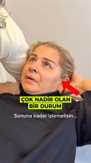 Fzt. Dr. Reşat Coşkun on Instagram: "Çok ciddi baş dönmesi ile geldi. Atlasın pozisyonel problemimden kaynaklı bir durumdu. ATLAS-AXiS METHOD yani “AX METHOD” ileri düzey bilimsel değerlendirme yöntemleri ve teknikler barındırır. Türkiye’de en fazla hastaya dokunmuş Kayropraktik uzmanı olarak uygulama ve vaka tecrübelerimlerimle birlikte 2 Yüksek lisans ve doktora düzeyindeki akademik ve bilimsel bilgilerimle bu “AX Methodu” oluşturdum. Herkese geçmiş olsun şimdiden🫠 🎓 📕 KİMİM BEN- ÖZGEÇMİŞ? 