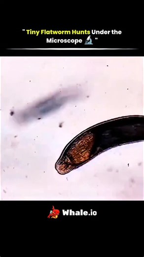 @solved_science | Flatworms like this one are multicellular organisms that thrive in aquatic environments, often found in pond water samples. Unlike... | Instagram
