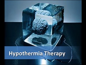 Hypoxic Ischaemic Encephalopathy