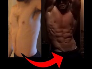 6 Year Pectus Excavatum Transformation Video