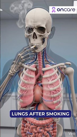 Can Your Lungs Fully Recover After Smoking? | Oncare #smoking #lungs