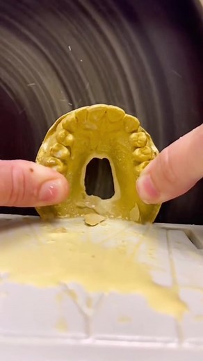 Let’s make a clear retainer! #dentist #tooth #teeth #education teeth cleaning plaque removal calculus removal on teeth rotten teeth tooth decay extraction abscess tooth removal cavity infection hole in tooth toothpaste teeth implants teeth care