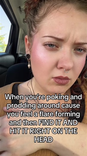 Hidradenitis Suppurativa Flare-Up Relief