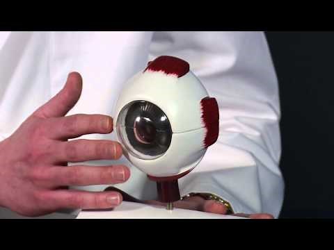 Dr Kluver - Subconjunctival Hemorrhage