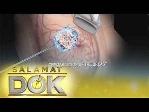 Breast Cancer | Salamat Dok