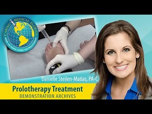 One minute Morton's Neuroma treatment with Prolotherapy