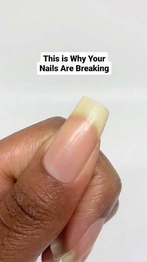 Stop Nail Breakage: The Right Nail File Matters