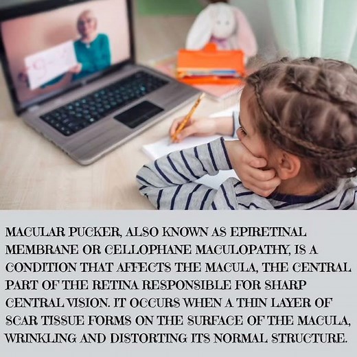 NATURAL HEALING FOR MACULAR PUCKER FOR HOMEOPATHY TREATMENT