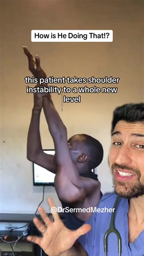 Understanding Joint Mobility and Dislocation Risk