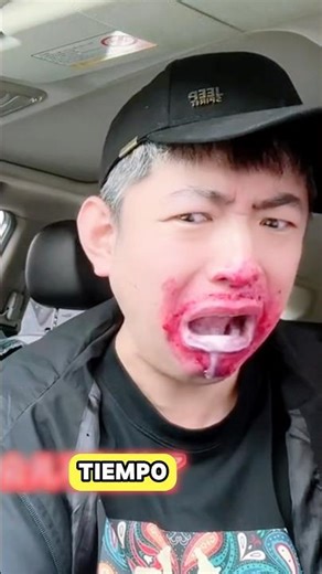 Cuando alguien está de mala suerte, hasta la pitaya puede comer.