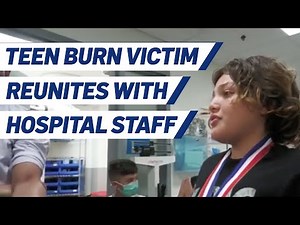 Burn Victim Reunites With Hospital Staff Who Saved His Life