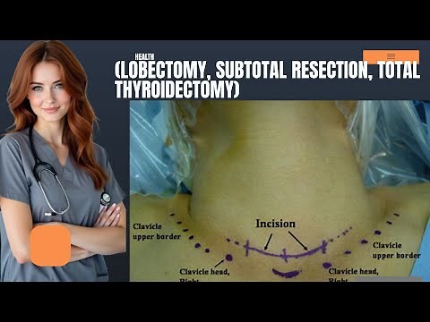 (Lobectomy, Subtotal Resection, Total Thyroidectomy)