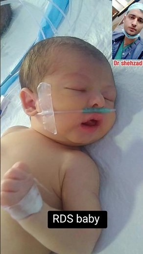 🩺 Respiratory Distress Syndrome (RDS) in Newborns | Medical Case