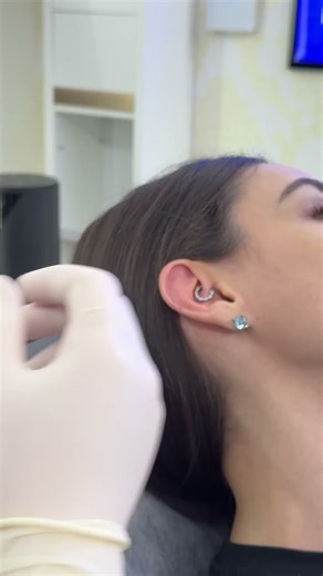 The Daith Piercing: Procedure, Healing, & Aftercare Guide #daithpiercing #earpiercing #helixpiercing