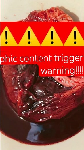 Placenta encapsulation process 😮‍💨 #placenta #encapsulation #motherhood #labor