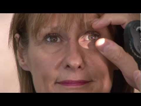 Ophthalmics Video 6 - Eye Exam