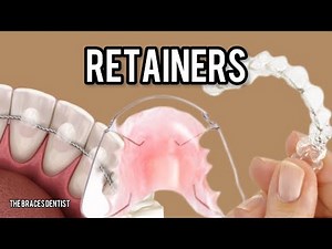 All about Retainers | The Braces Dentist