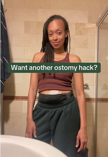 Ostomy hack. Burping your ostomy bag. #ostomy #ileostomybag #colostomy #stoma #ibd